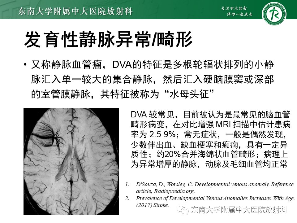 影像学|脑动静脉畸形影像学特征