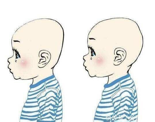 颜值|宝宝睡扁头长大颜值高知道这些影响后,谁再坚持睡跟谁急