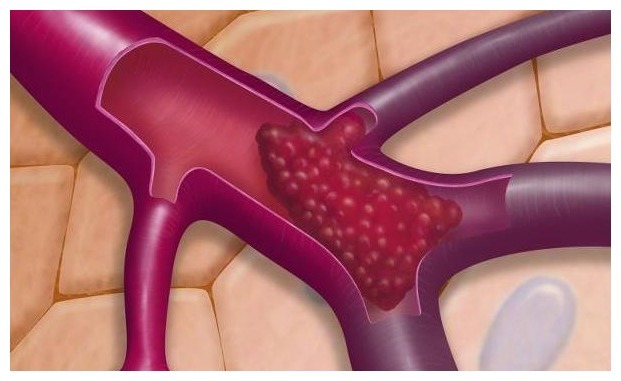 中老年人|经常吃“腐乳”的人，最后怎样了或许少数人才知道，不妨看看吧