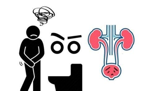 高钙血症|实不相瞒!这种症状若出现,或是肾癌已到来,千万别再拖!