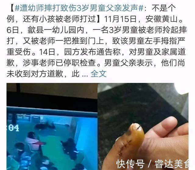 家长|3岁男孩被幼师“摔飞”,园方却示意别声张, 看完监控宝爸怒了