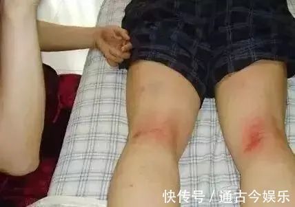 拍打|人体有8虚,学会拍一拍,清肺气化肝郁健脾胃通经络,百病远离!