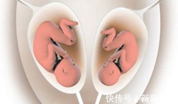 排卵|不装了,摊牌了!做试管婴儿的确是有并发症的!