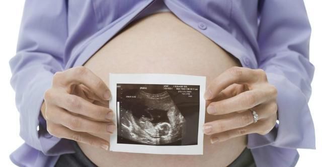 NT|NT检查是孕检方式,你知道染色体和NT有关系吗?