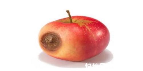 病变|被胃癌“喜欢”的人,一般都有这5个特点!希望你没有