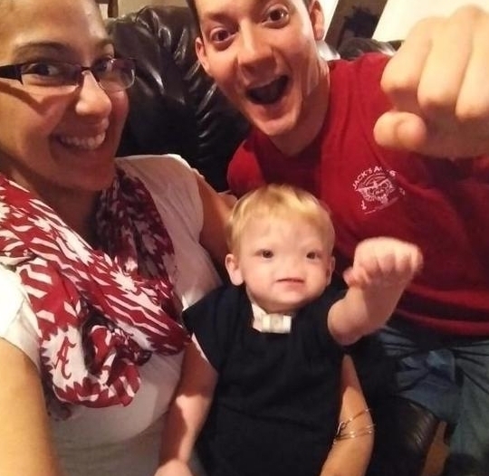 婴儿|“无鼻婴儿”惨遭唾弃，两年后再见宝宝的样子，让人感动羞愧！