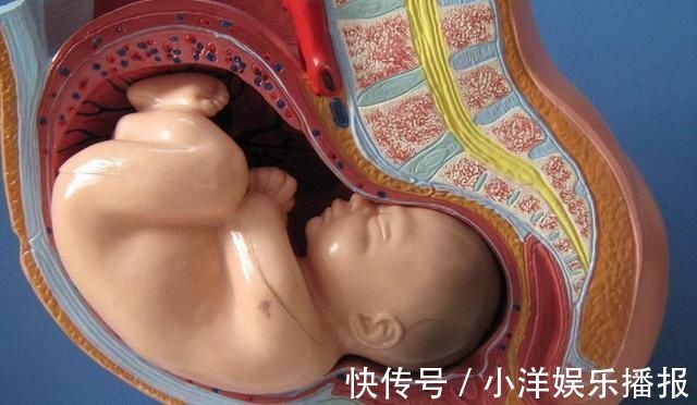 丈夫|妻子顺产不下来,丈夫拒绝剖宫产,结果妻子孩子没有保住