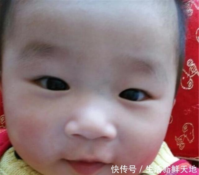 困难型|宝宝鼻梁上有“青筋”,体质差脾气也大别因误会忽略真正的诱因!