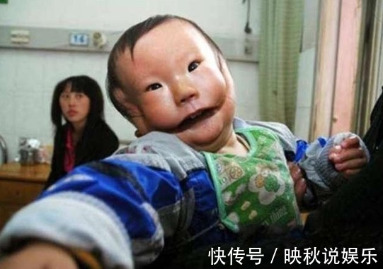 小陈|产妇生下''面具婴儿“,面部断裂像带面具,医生怒斥不配当妈