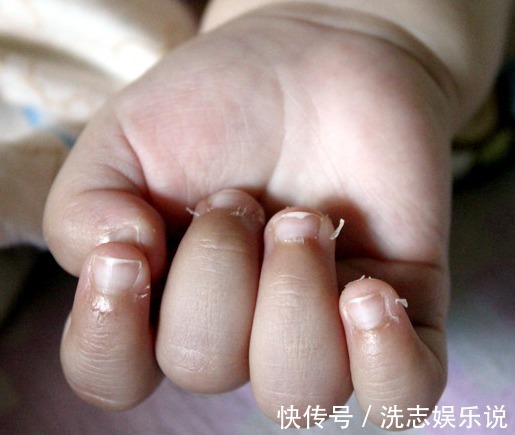 瘦肉沫|娃发出4个信号,说明缺锌了,多吃这几种食物,宝宝更高、更聪明