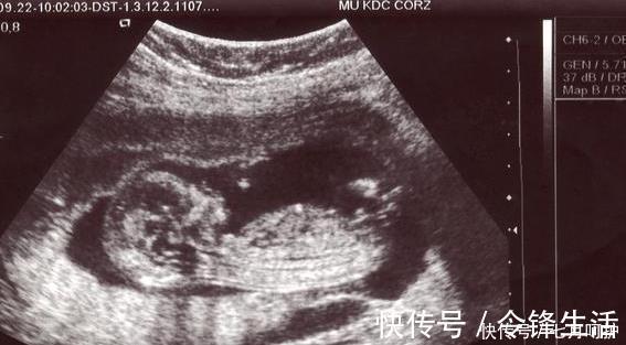 死因|27岁产妇二胎坐月子期间意外猝死,得知死因岳父怒将女婿告上法庭