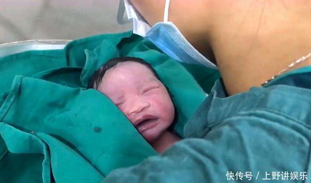 猪油|新生儿全身涂满“猪油”,母子相见吓坏产妇医生这是好事