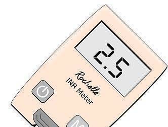 手抖|全身没力气、心慌、手抖,很可能这个指标亮“红灯”,别一拖再拖