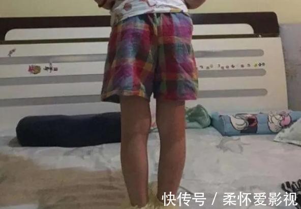身高|孩子这三个部位“短”,将来可能不会高,希望你的孩子一个都没中