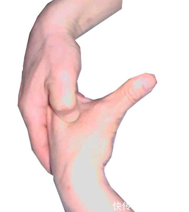 睡眠|失眠的人,虎口有个点特别疼!用力掐就睡好了