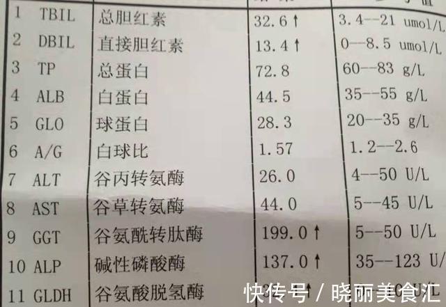 肝细胞|转氨酶、胆红素都升高,医生说没事,肝功能检查单怎么看?