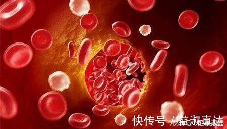 -3|养血管,防血栓,记住“两个字”,多做“两个运动”,了解一下