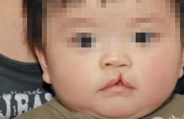 怀孕|产妇生出“兔唇儿”,谎称孕期吃了兔肉,被揭穿后婆婆很生气