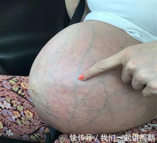 三胞胎|生完三胞胎后肚子却收不回去,国外宝妈的晒照,诠释伟大母爱