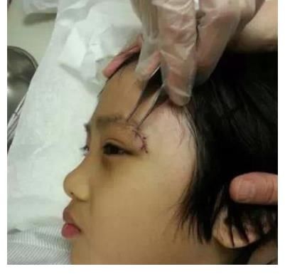 艺人|太危险!《中餐厅》多位艺人摔倒,棚顶突然坍塌,安全问题引争议