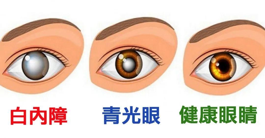 眼病|国医大师廖品正：内障眼病治疗三法