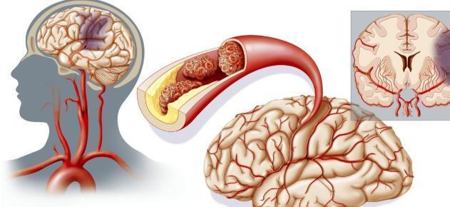 渗透压|糖尿病病人,究竟是多喝水还是少喝水?医生一文给说清楚