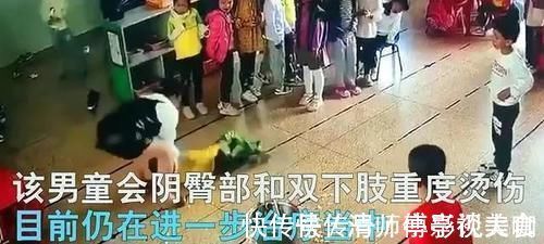 烫伤|5岁男童跌进滚烫的汤桶里,造成重度烫伤!老师一个举动坑惨了娃……