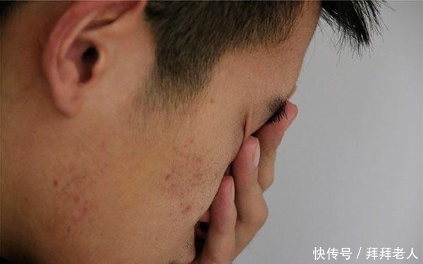 黄芪|经常喝黄芪泡水的人,后来怎样了?黄芪能不能天天喝?告诉你答案