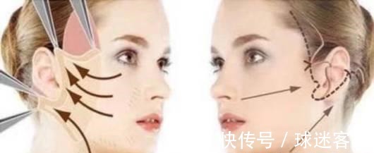 大拉皮 王小民教授做小拉皮的人逐渐增多,网上传言却没有效果!