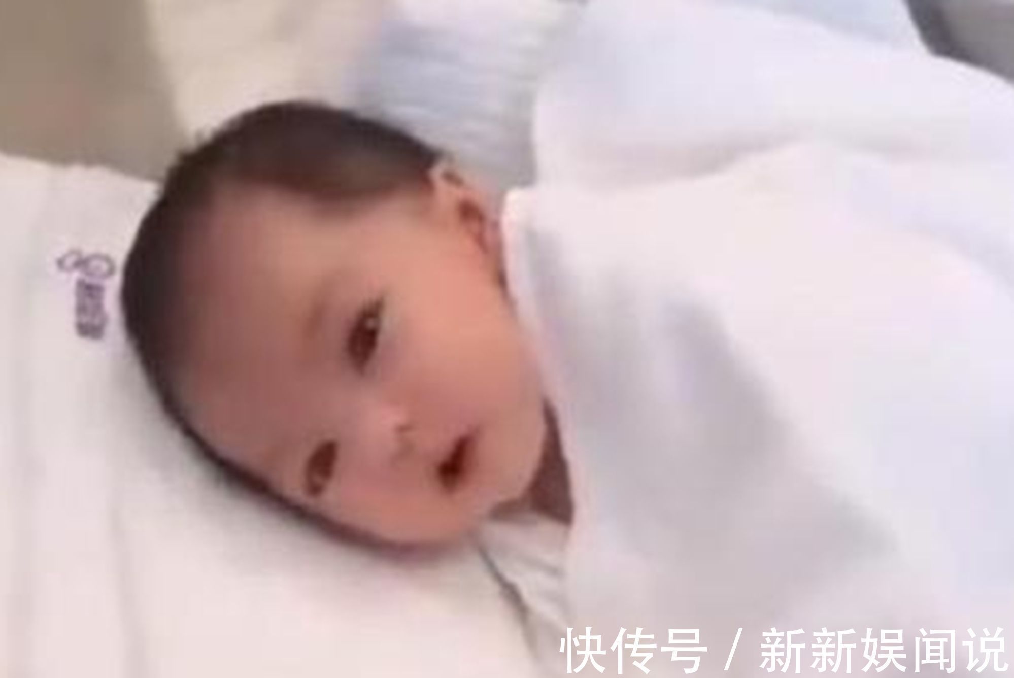 维娘胎里“整容”是什么体验?医生:孕期注意,你的孩子也不会丑