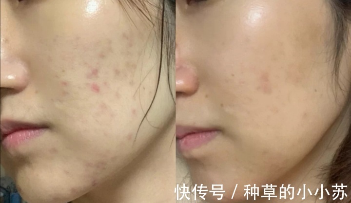 成分|平价护肤品,便宜大碗不踩雷!学生党也能负担得起的护肤品都在这