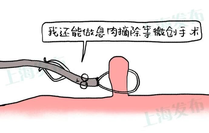 麻醉|【医聊】肠息肉是怎么长出来的？要不要割？