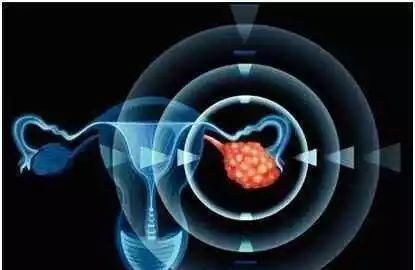 妇科病|发现妇科病一定要治疗吗?提醒:此3种“疾病”一般不用治