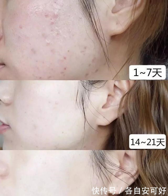 贫窟女孩 属于“贫窟女孩”的3款护肤品，因价格便宜嫌弃，但却都有真本事！