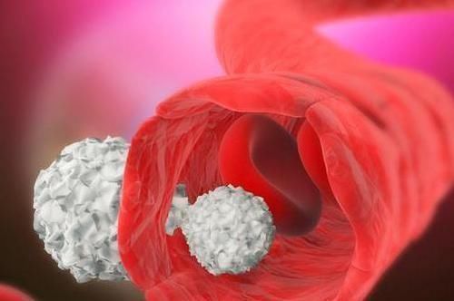 缺铁性贫血|每天喝一杯葡萄干泡水,5件喜事可能不请自来,很多人看完心动了