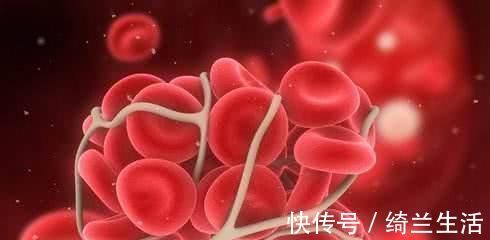 凉拌木耳|这东西被丢在厨房角落,却是“天然阿司匹林”,常吃让血栓靠边站