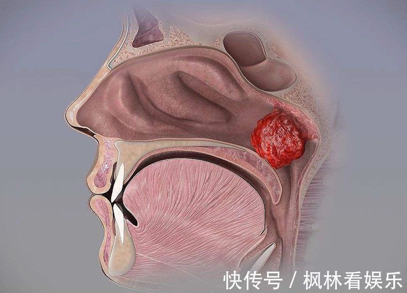 呼吸|孩子每次用嘴呼吸都是在“毁容”,改不掉这坏习惯,只会越长越丑