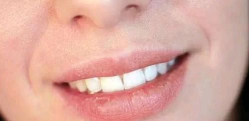 女人|这4个坏习惯,会让女生的嘴唇越来越丑!你也有的话,尽量改掉吧