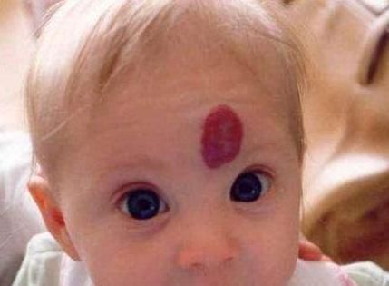 生长发育|孕期,孕妈不注意这4件事,可能宝宝出生脸上有胎记,影响颜值