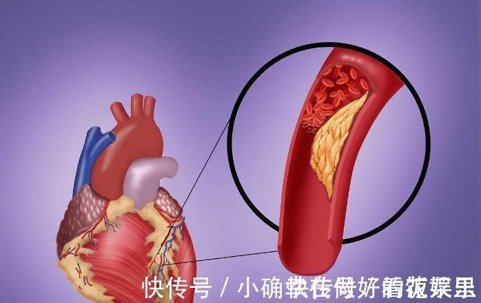 豌豆蛋白粉|大米粥里加它们,赶走一身血栓,每天泡一杯,帮助活血化瘀清血管