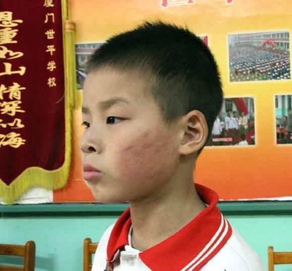 外婆|上课被叫出来,9岁男生被同学家长拖拽殴打,施暴者还有一名孕妇