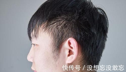 身体|身体好不好,从头发能看出来?白发生长位置不同,暗示不同疾病?