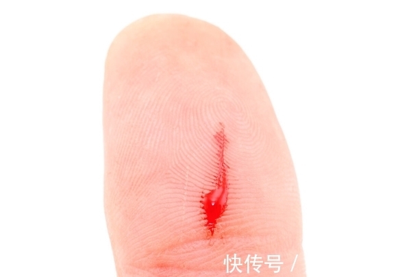 李女士|42岁女子查出宫颈癌，3个月后离世，医生：3件事做太多了，愚昧