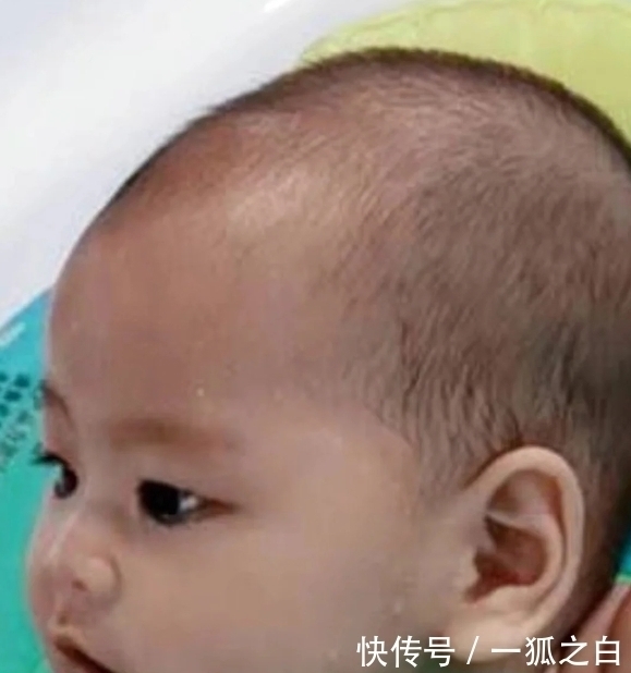 柳果刺锌|儿科医生:坚持1个法子,一周内,可以赶走娃的积食