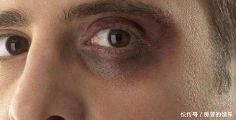 肾脏|“肾好”的男人才好若身体出现“3黑1臭”，多半是“肾”在求救