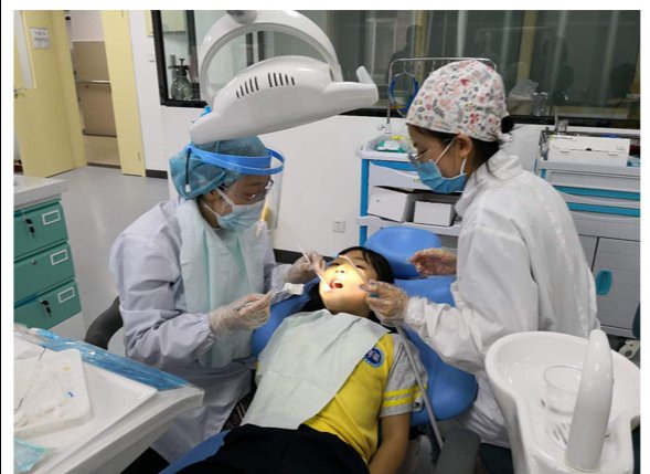 筷子|孩子去医院修牙，竟然在脖子里意外发现一截筷子