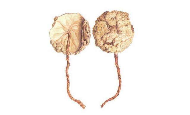 判断|胎盘是否老化怎么判断？关系胎儿发育的关键，孕妈不可大意