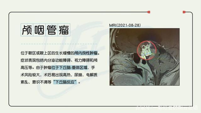 竟然真的在综艺《令人心动的offer3》中,有机会直面生死