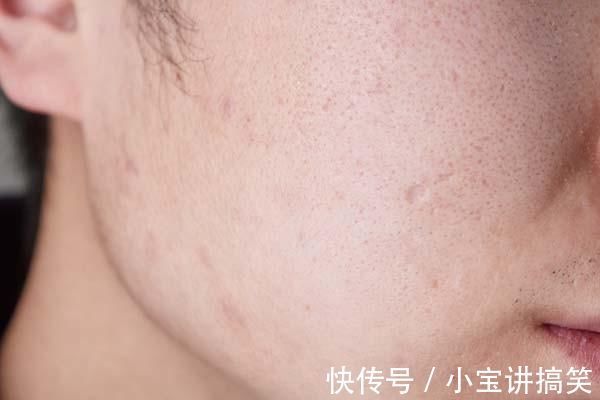 肚子|给减肥的人提醒：身体的哪些表现，代表你已经开始变瘦了？