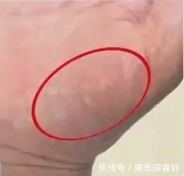 生命线|观手知健康！快速辨识高血压、高血糖就这么看，2分钟学会！